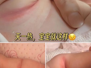 宝宝下面湿透还嘴硬疼是为啥？如何缓解？