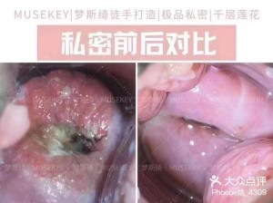 未成年女生的私密部位长什么样正常？为什么会有不同的形状和颜色？如何保护私密部位的健康？