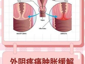 女生多次同房后私处肿胀是为什么？如何缓解这种不适？