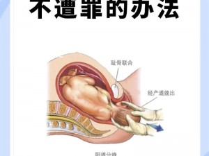 帝王肚腹挺起难产塞胎头-难产帝王肚腹挺起，胎头如何娩出？