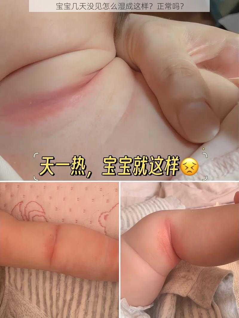 宝宝几天没见怎么湿成这样？正常吗？