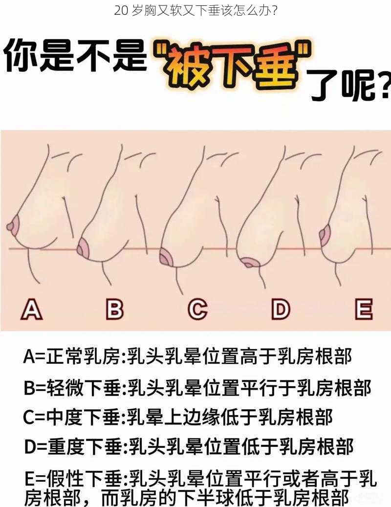 20 岁胸又软又下垂该怎么办？